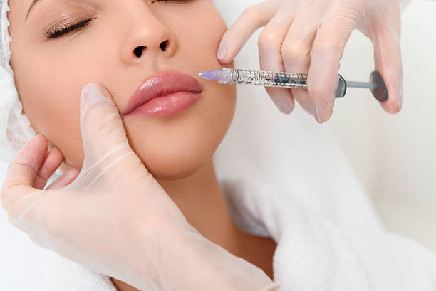 Can Russian Lip Fillers Boost Lip Confidence