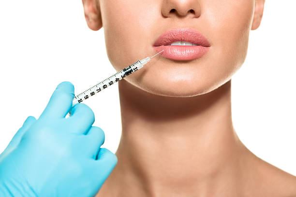 Can Russian Lip Fillers restore youthful lips