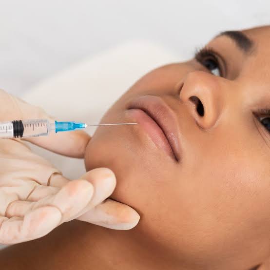 Create a Balanced Smile with Lip Fillers