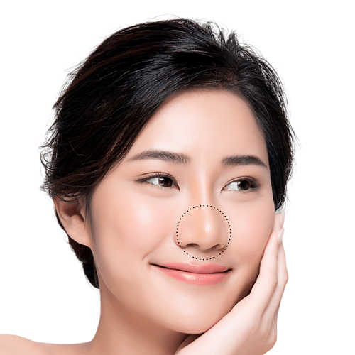 Nose Tip Plasty in Abu Dhabi