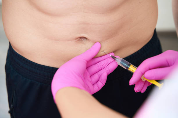 How Do Fat Dissolving Injections Work