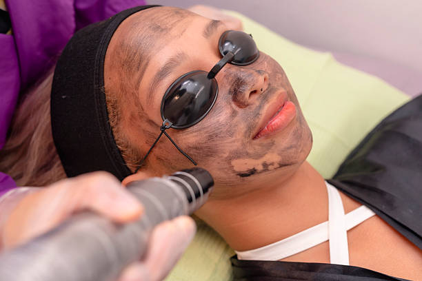 How Does Pico Laser Treatment Remove Spots?
