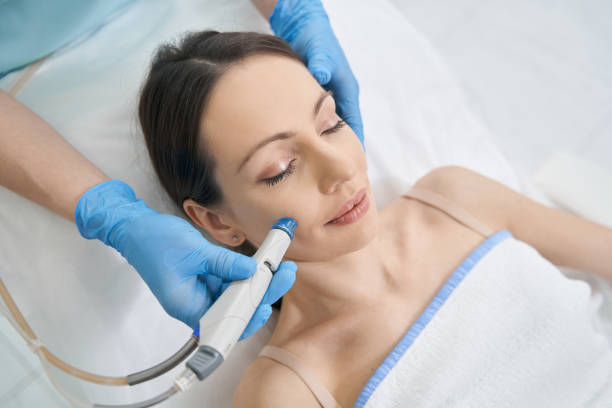 How Soon Does Microdermabrasion Treatment Show Results
