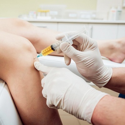 How Successful Are PRP Injections for Knees?