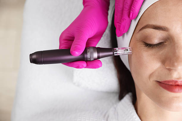 Is Dermapen Treatment Best for Scar Reduction