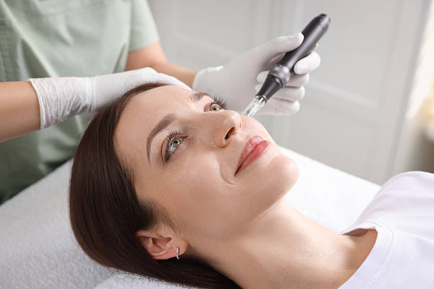 Is Microneedling a Good Option for Skin Repair