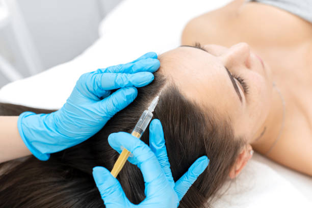 Why Consider Exosome Therapy for Hair Care